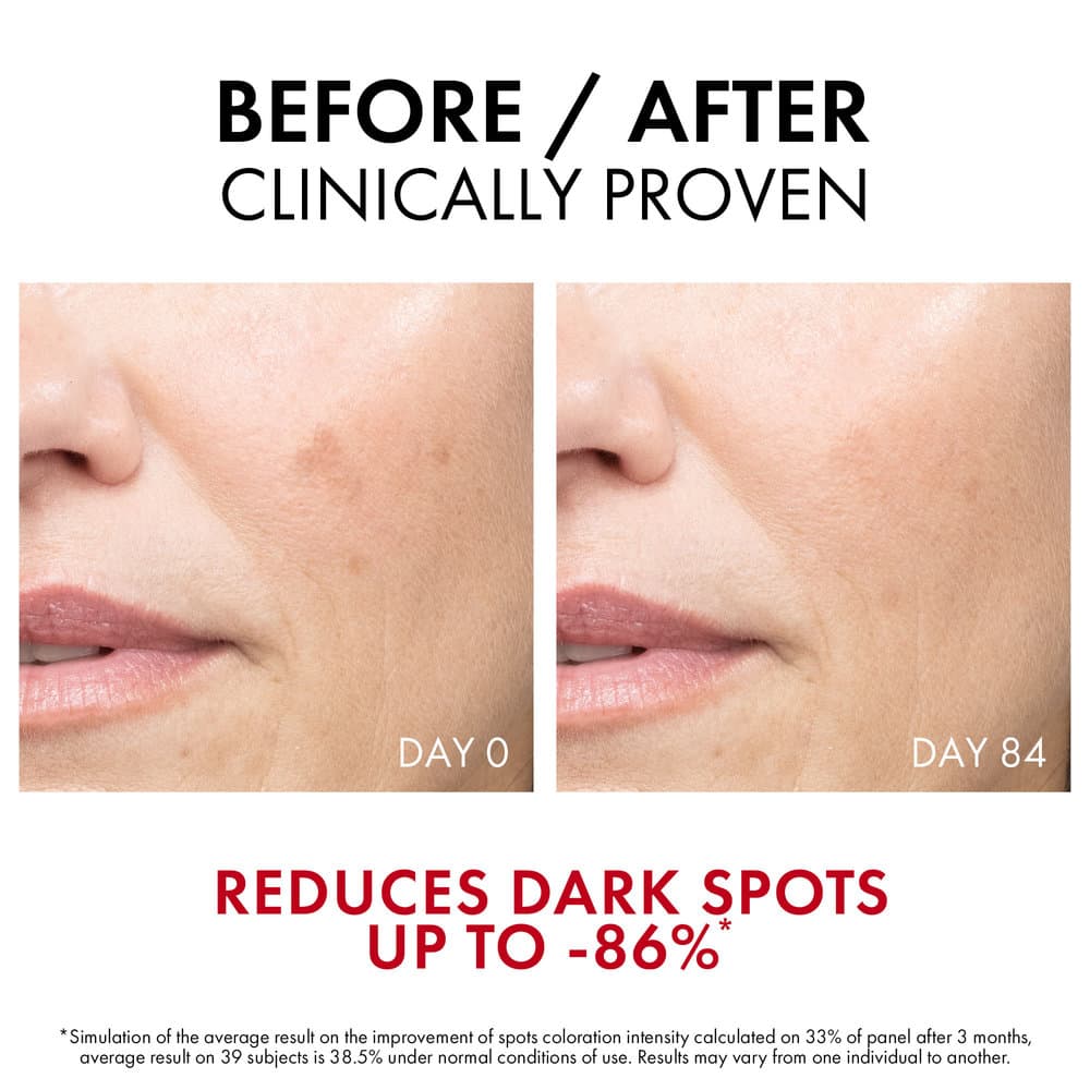Vichy Liftactiv Specialist B3 Dark Spots Serum 30 ml - 5